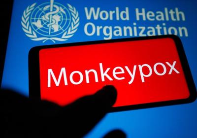 Fight monkeypox together: WHO
