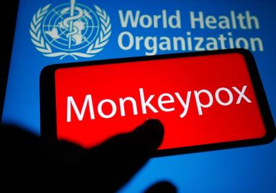 Monkeypox pandemic unlikely