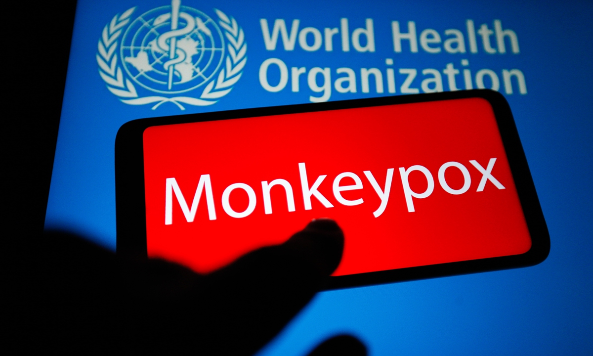 Monkeypox pandemic unlikely